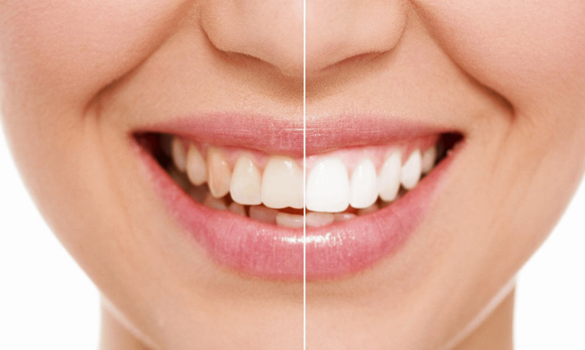 Affida il tuo sorriso a dei professionisti scegliendo il giusto studio dentistico